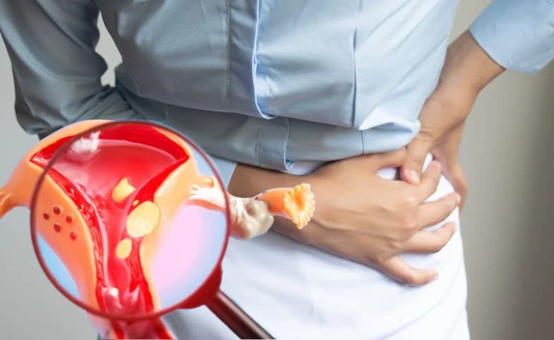 Mengenal Endometriosis yang Bikin Sulit Hamil dan Pengobatannya